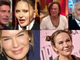 Before and after photos of Hollywood celebrities with shocking plastic surgery fails