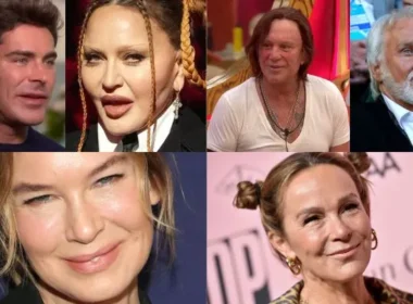 Before and after photos of Hollywood celebrities with shocking plastic surgery fails