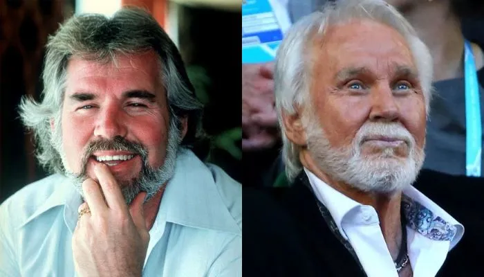 Kenny Rogers before and after plastic surgery showing visible eye and face alterations