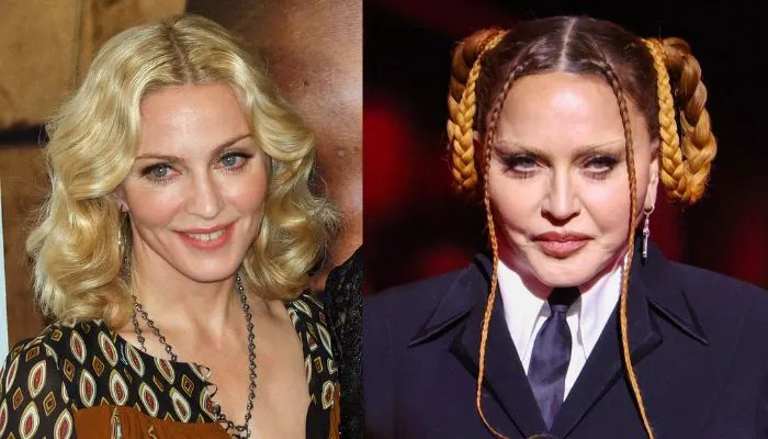 Image showing Madonna’s facial changes over the years with emphasis on cosmetic procedures