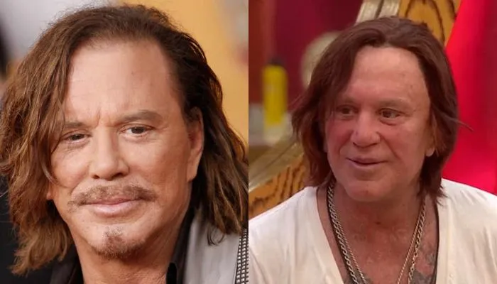 Mickey Rourke’s transformation from actor to boxer to post-surgery appearance